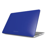 Electric Azure - Macbook Case