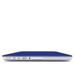 Electric Azure - Macbook Case