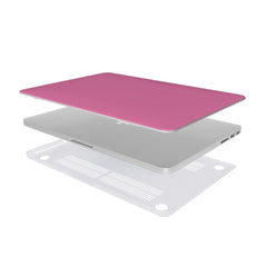 Pink Lady - Macbook Case